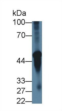 Nicotinic Acetylcholine R alpha 3/CHRNA3 Antibody