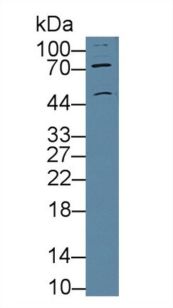 Nicotinic Acetylcholine R alpha 3/CHRNA3 Antibody