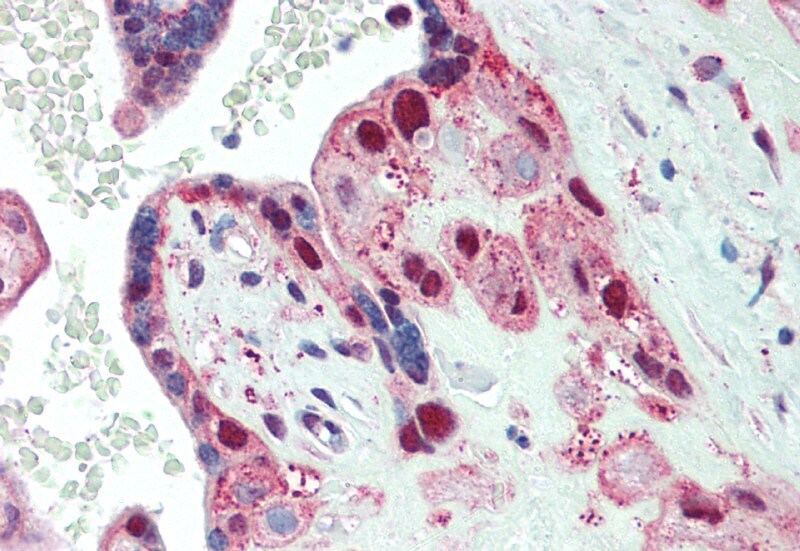 SPTBN4 Antibody