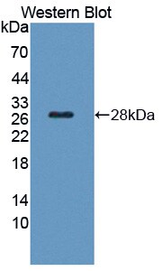 SRY Antibody