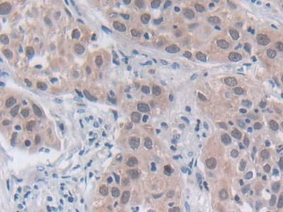 SRY Antibody