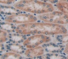 FNTA Antibody