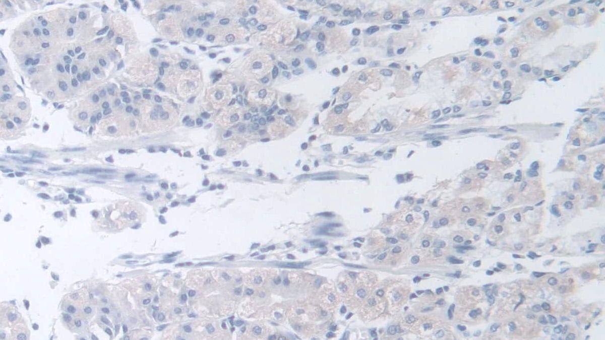 B4GALNT2 Antibody