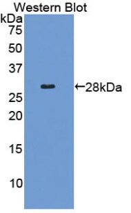COL4A2 Antibody