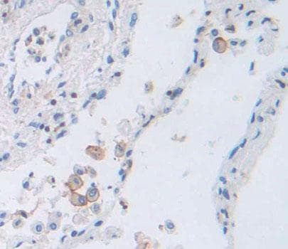 PCDH20 Antibody