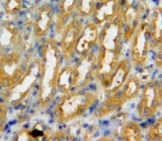 PAD3 Antibody