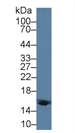 Hemoglobin delta Antibody