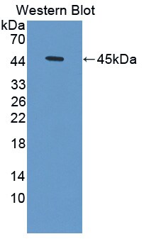 Hemoglobin delta Antibody