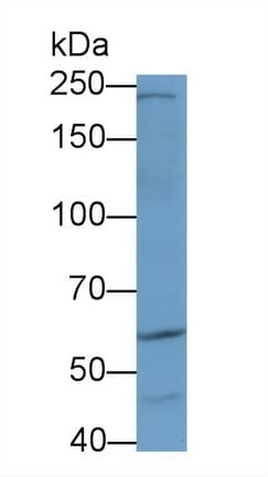 AKAP11 Antibody