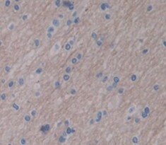 LARGE Antibody