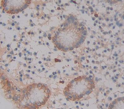 ABCA12 Antibody
