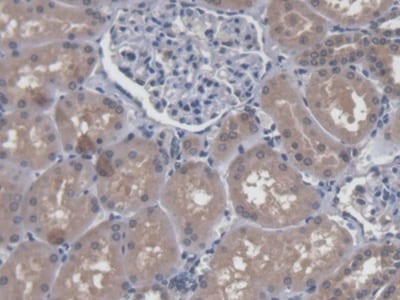 CROP Antibody