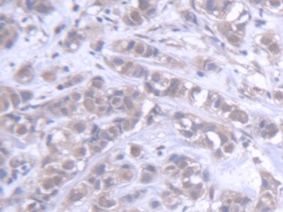 ABCB6 Antibody