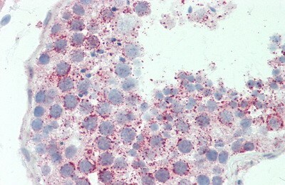 ABCB6 Antibody