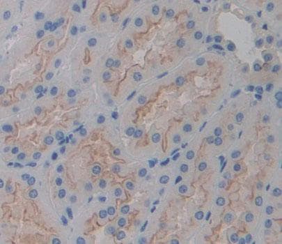 PLCH2 Antibody