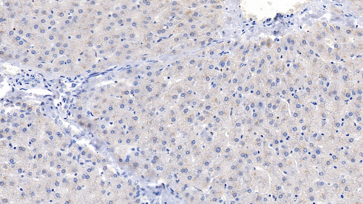 PLC-delta 3 Antibody