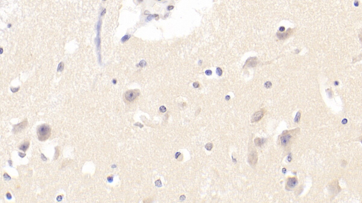 PCDHGA2 Antibody