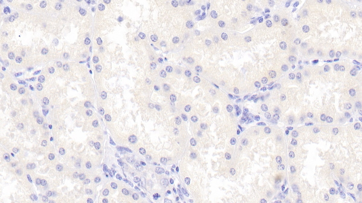 Cerebellin-1/Precerebellin Antibody