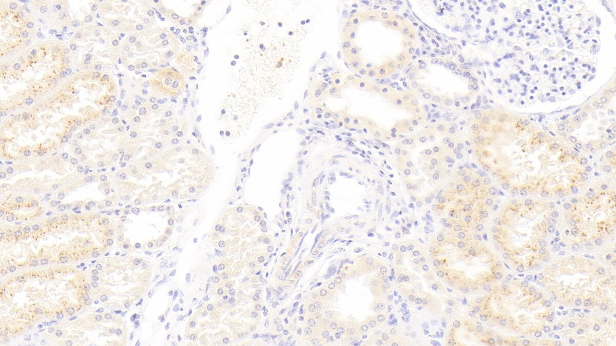 IFN-alpha F/IFNA21 Antibody