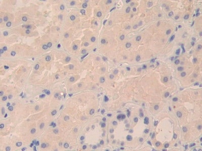 TPSD1 Antibody