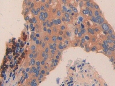 TPSD1 Antibody