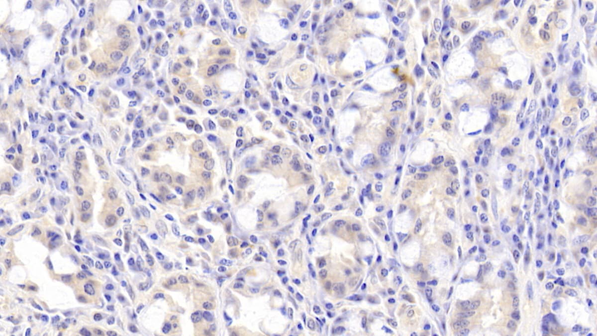 FLRT3 Antibody