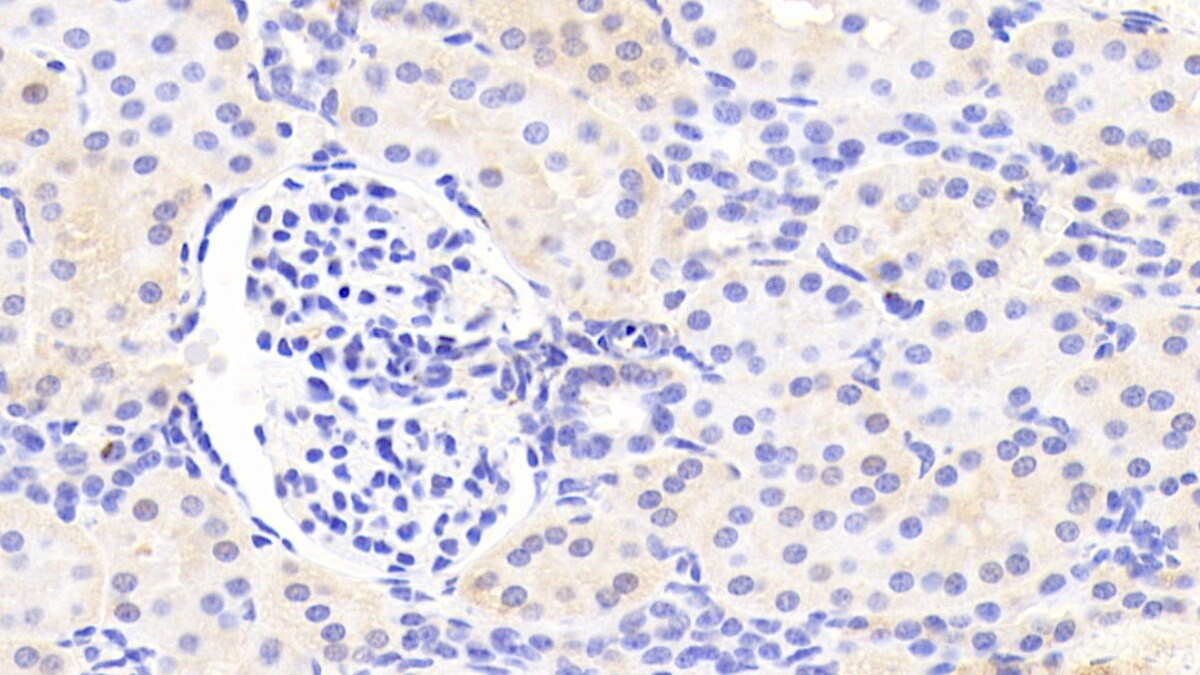 ARSF Antibody