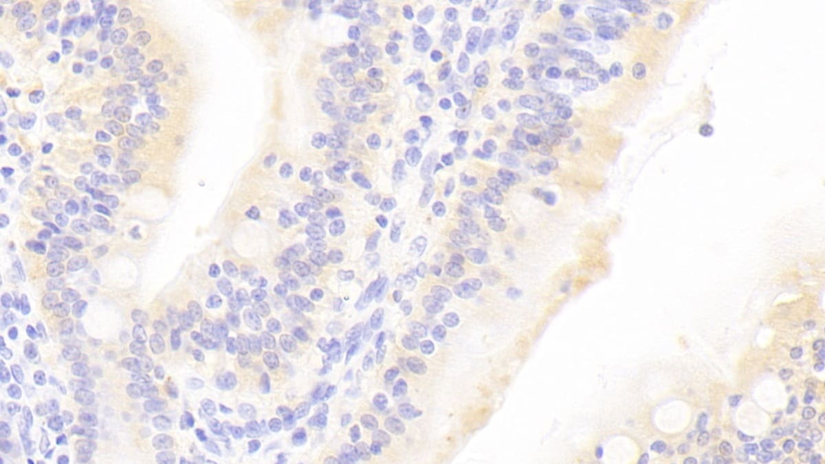 TAS2R38 Antibody