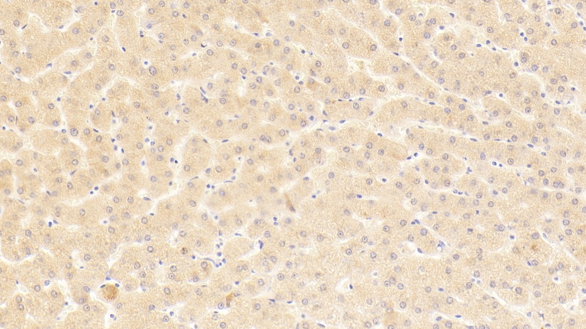 CPN2 Antibody