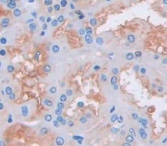 CMTM1 Antibody