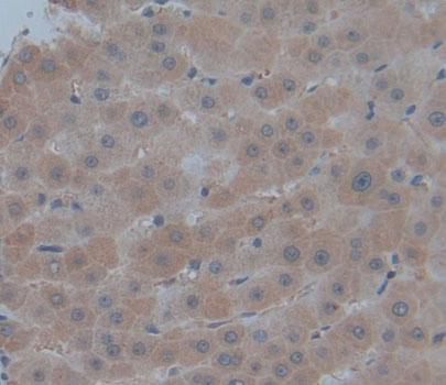 PMM1/Phosphomannomutase 1 Antibody