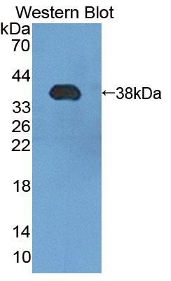 PMM1/Phosphomannomutase 1 Antibody