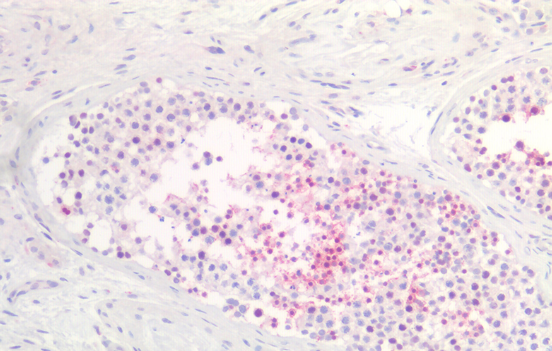 SLC26A8 Antibody