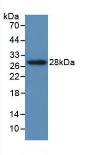 PTHLH/PTHrP Antibody (C2)