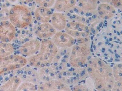 Serpin A6/Cortisol Binding Globulin Antibody (C7)
