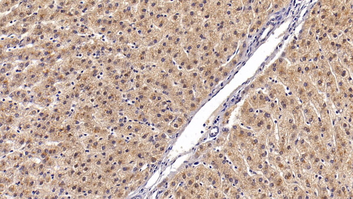 Angiostatin Antibody (C36)