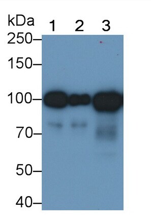 Angiostatin Antibody (C5)