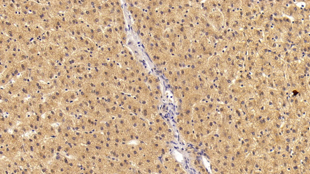 Angiostatin Antibody (C34)