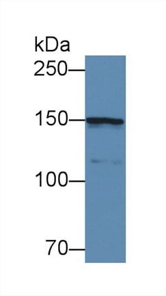 Collagen IV alpha5 Antibody