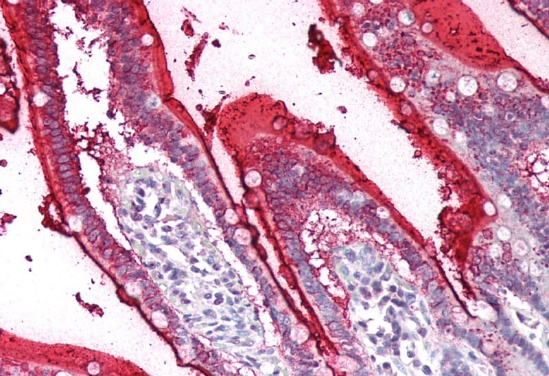 SI Sucrase-Isomaltase Antibody