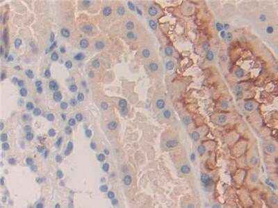 KIR2DS2 Antibody