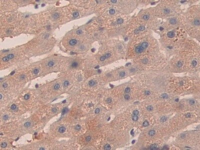 KIR2DS2 Antibody