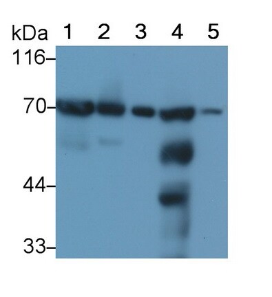 SDHA Antibody (C1)