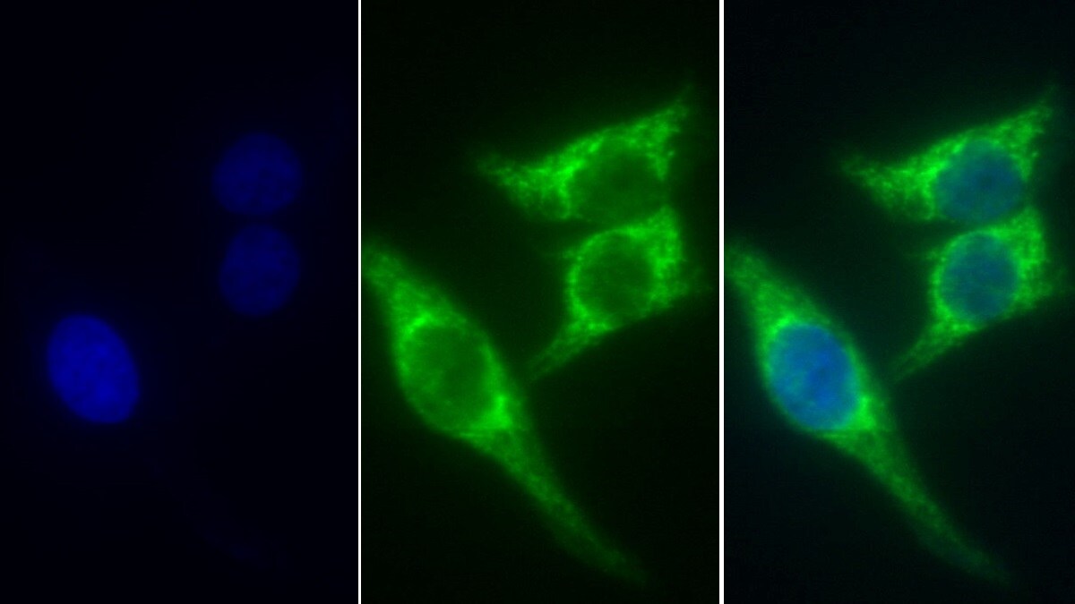 SDHA Antibody (C1)