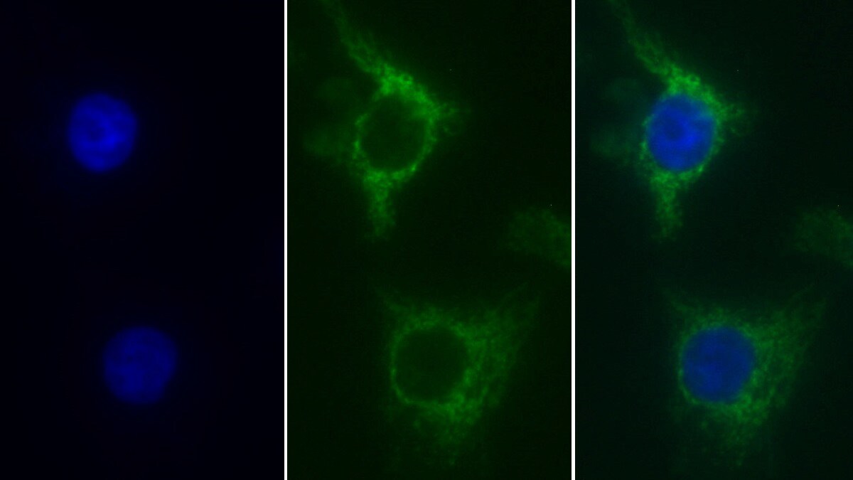 SDHA Antibody (C2)