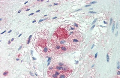 NG2/MCSP Antibody (6#)