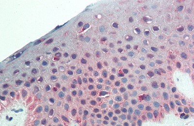 NG2/MCSP Antibody (6#)