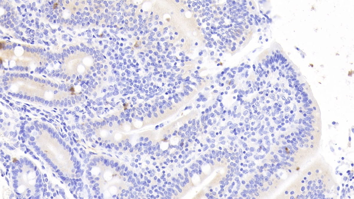 Neurotensin Antibody (C5)