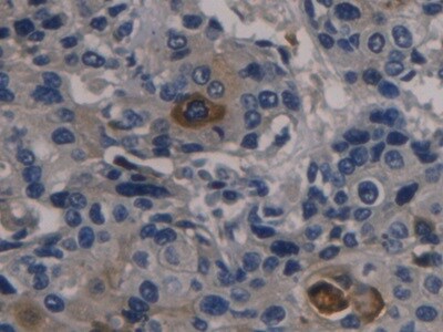 Orosomucoid 2 Antibody (D7)