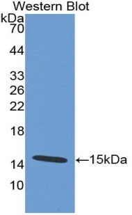 Defensin alpha 5 Antibody (9#)